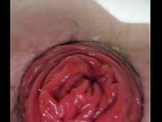 Gaping and Rosebud